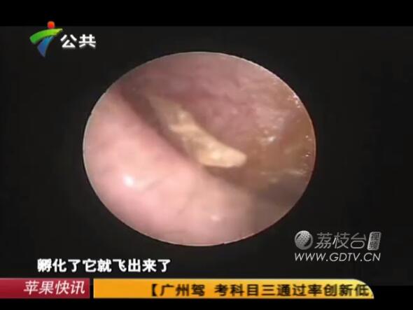 �@�֣����Ӷ���(n��i)�L(zh��ng)�M��ɫ���x��˺ҧ����ʹ��������