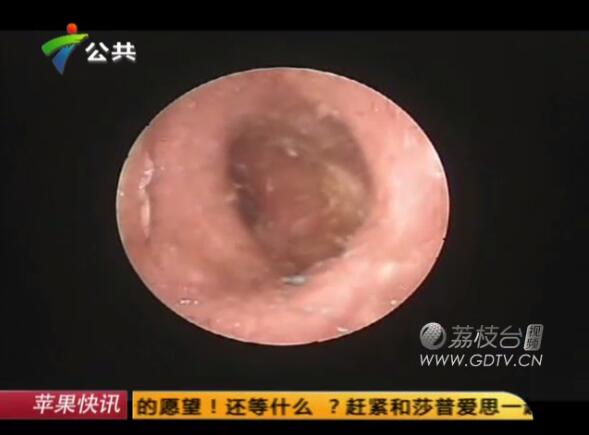 �@�������Ӷ���(n��i)�L(zh��ng)�M��ɫ���x��˺ҧ����ʹ��������