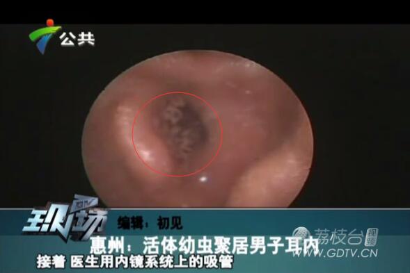 �@�������Ӷ���(n��i)�L(zh��ng)�M��ɫ���x��˺ҧ����ʹ��������