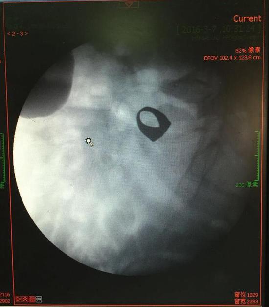 ��Ѯ�����š����g�ɷ�����13�˽��ָ