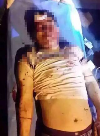 少婦開(kāi)車撞死人哀求別報(bào)警 家人賠130萬(wàn)善后